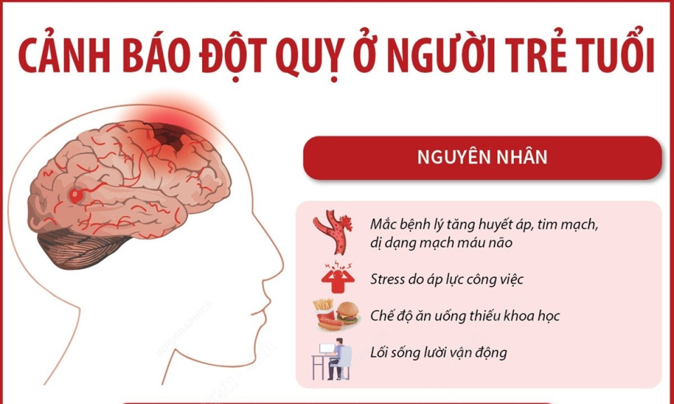 Tình trạng đột quỵ ở người trẻ tuổi đang trở nên đáng báo động