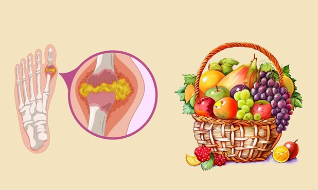 Chống lại axit uric cao nhờ những loại trái cây quen thuộc giàu vitamin B12