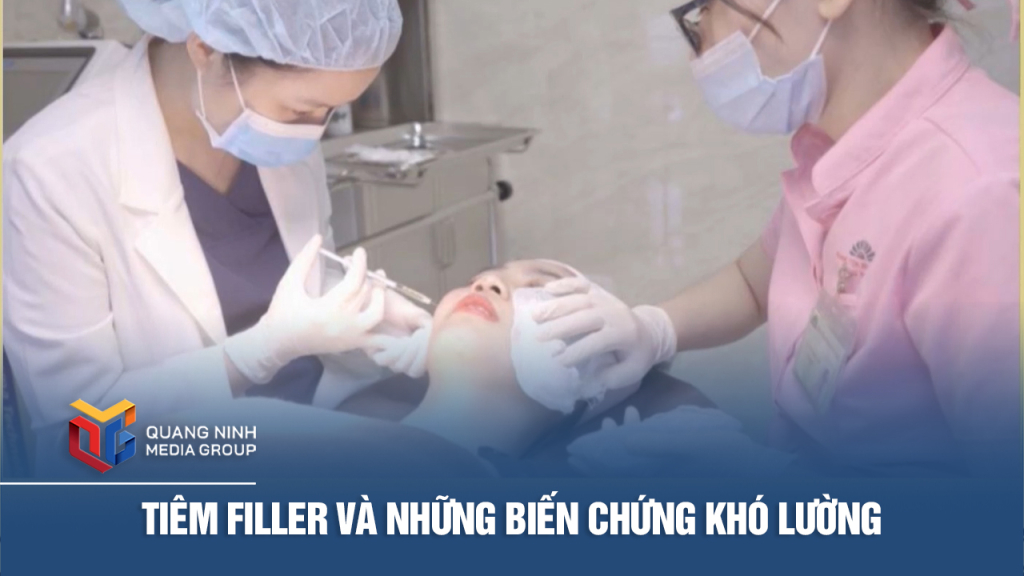 Tiêm filler và những biến chứng khó lường
