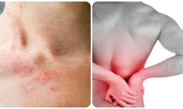 Những triệu chứng suy thận nhẹ bạn cần biết