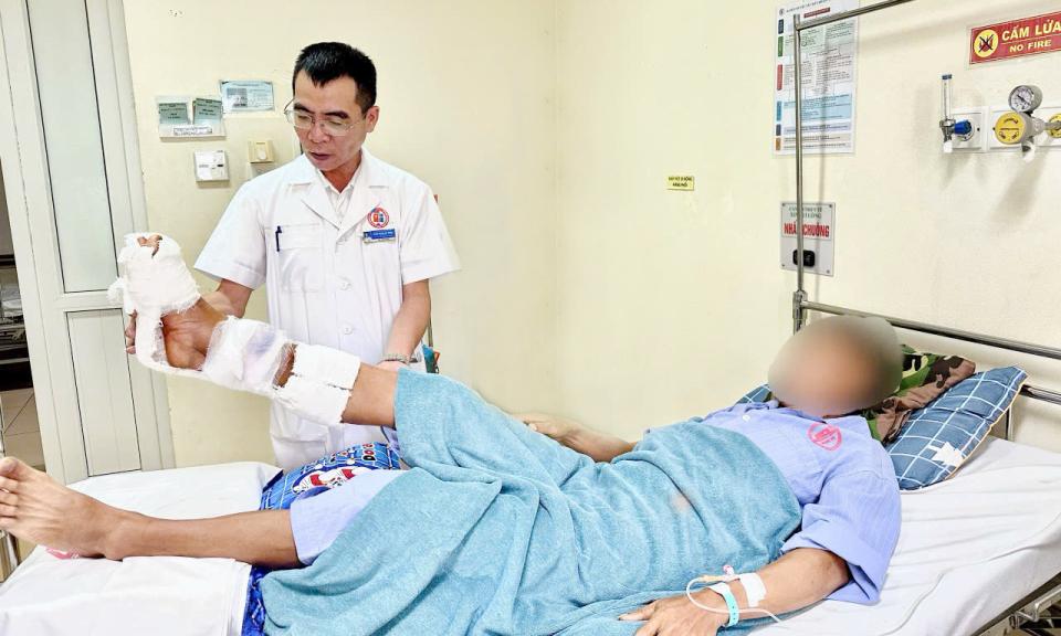 Nối thành công cẳng chân gần đứt rời cho người bệnh