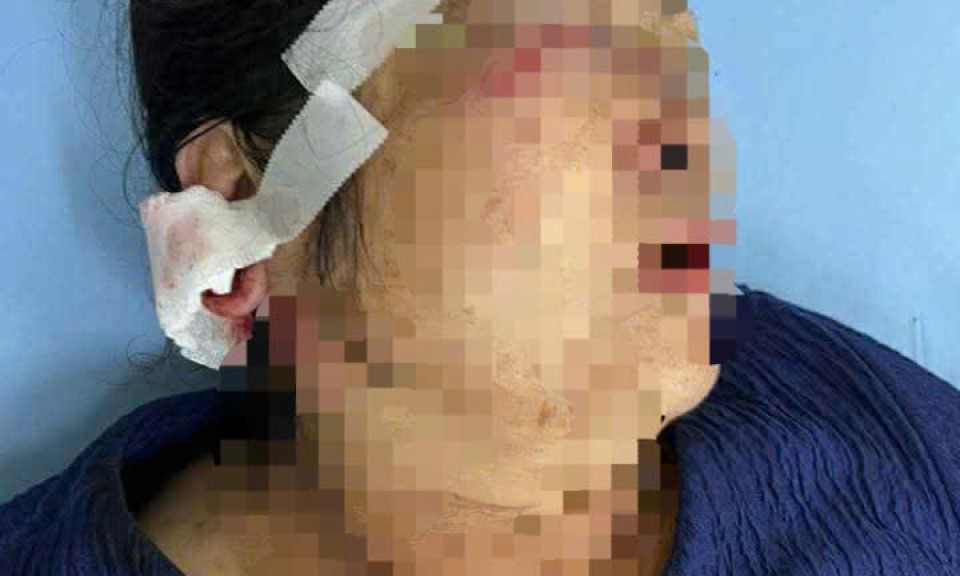 Truy xét nhóm thanh niên hành hung người phụ nữ lớn tuổi ở Lâm Đồng