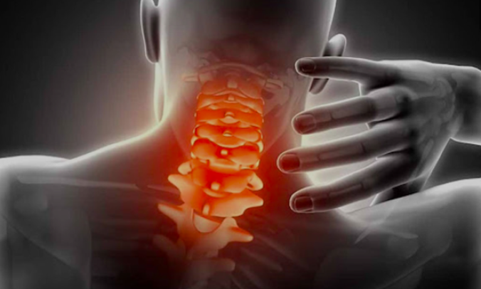 Đau cổ vai gáy có thể bị liệt nếu điều trị sai cách