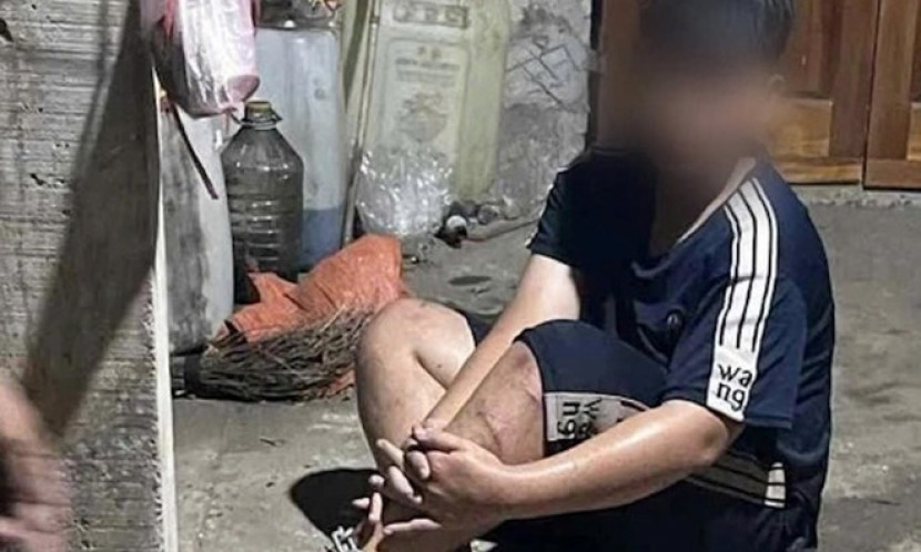Làm rõ vụ bé trai bị người đàn ông dùng dây xích trói chân, hành hung