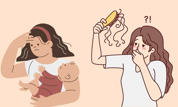 3 sai lầm phổ biến gây rụng tóc ở phụ nữ sau sinh