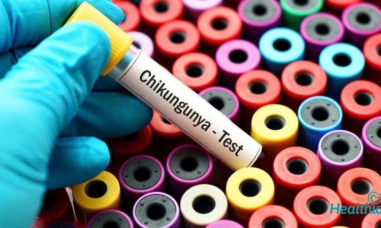 WHO cảnh báo nguy cơ lây lan cao của virus Chikungunya