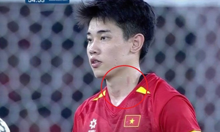 Đình Bắc giữ bình tĩnh dù bị đối thủ chơi xấu ở chung kết U23 Đông Nam Á