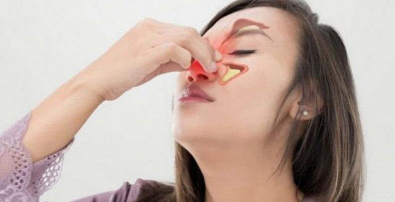 Viêm xoang dị ứng: Những lưu ý cần biết để điều trị kịp thời - Bệnh Viện Đa  Khoa Quốc Tế Bắc Hà