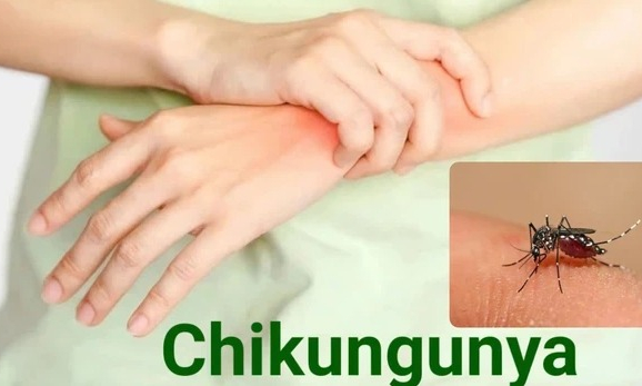 Bệnh Chikungunya đang diễn biến phức tạp, ai cần cẩn trọng?
