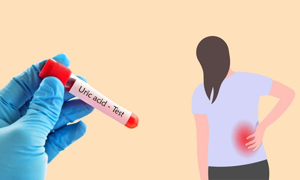 Nguyên nhân âm thầm khiến axit uric tăng cao ở người trẻ tuổi