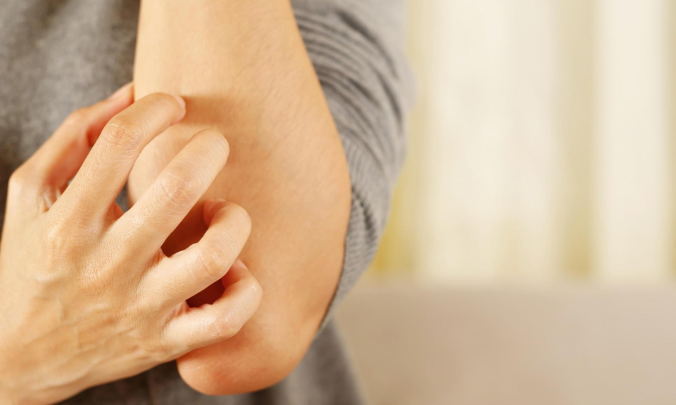 Mẩn ngứa kéo dài không rõ nguyên nhân có thể là tín hiệu gan đang kêu cứu