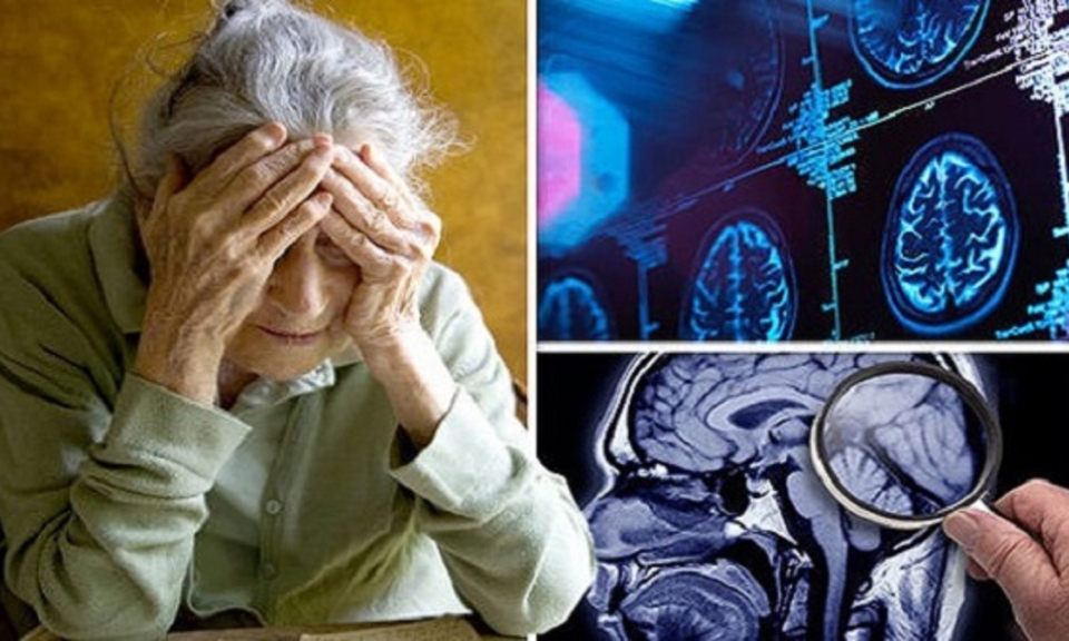 Hướng đi mới trong cuộc chiến chống bệnh Alzheimer