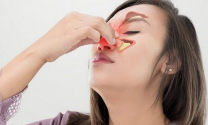 Viêm xoang mũi dị ứng chữa thế nào?