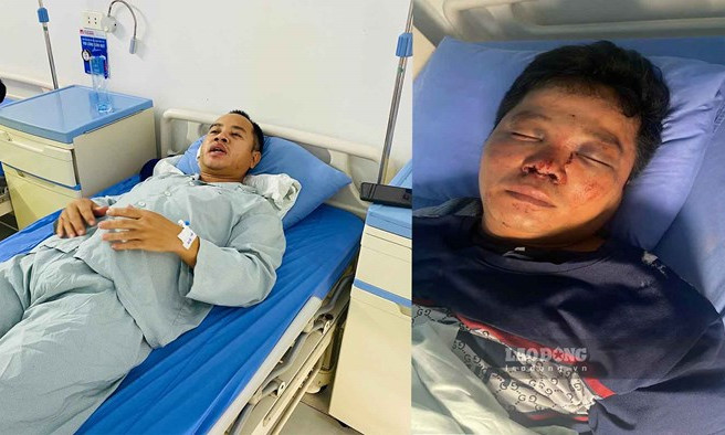 Tình hình sức khỏe 2 anh em bị đánh nhập viện khi cứu người gặp tai nạn