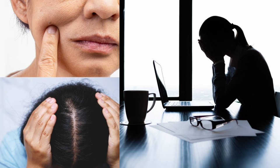 Vì sao căng thẳng khiến da xấu, tóc yếu